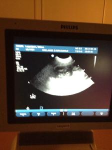 Ultraljud Wilma 2013